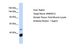 ANKRD12 Rabbit anti-Human, Polyclonal, Novus Biologicals 0.1ml; Unconjugated:Antibodies,